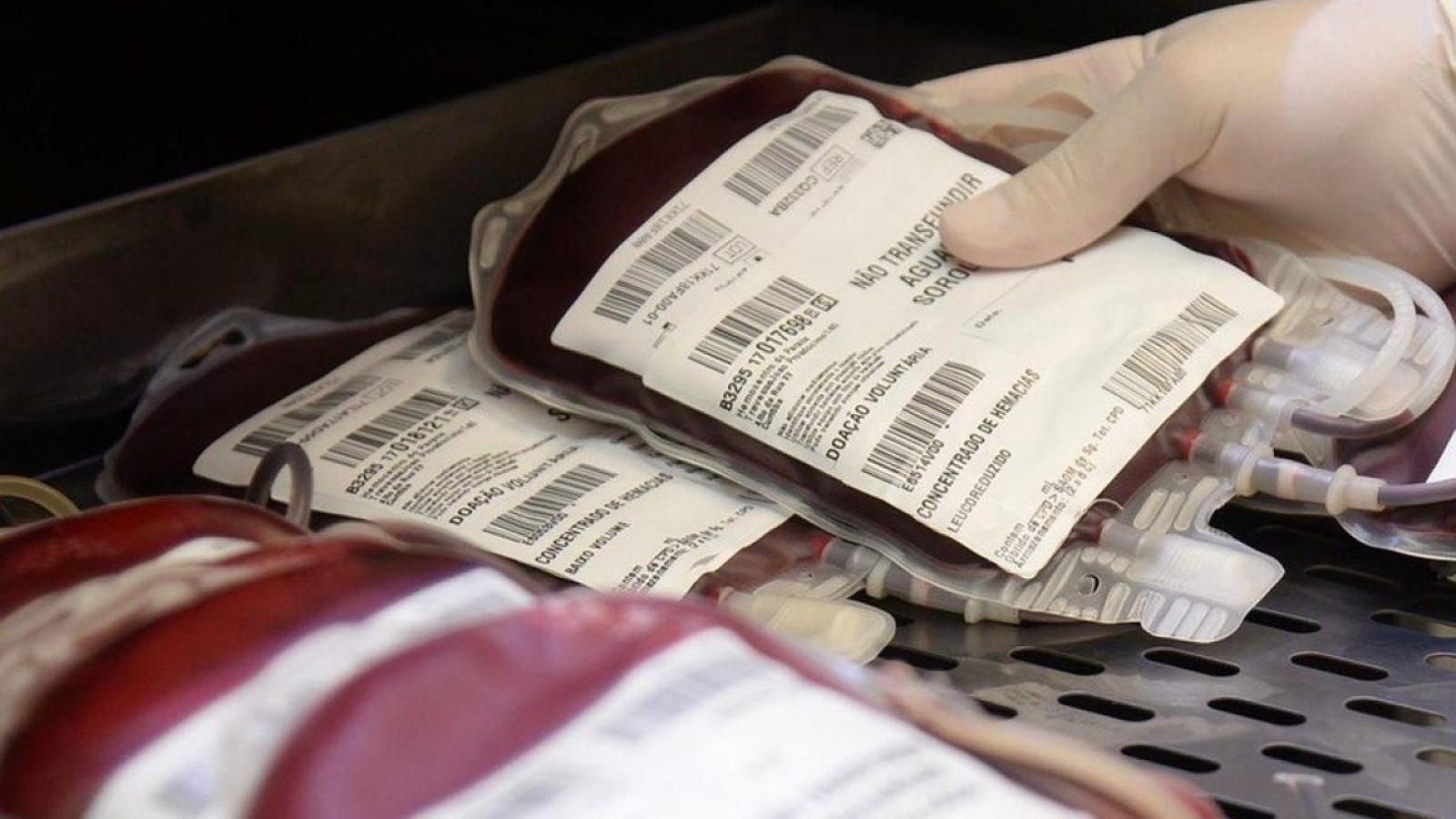 Brasil Desperdiça 18 Milhões De Litros De Sangue Ao Ano Por Preconceito